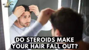 Do Steroids Make your Hair Fall Out?