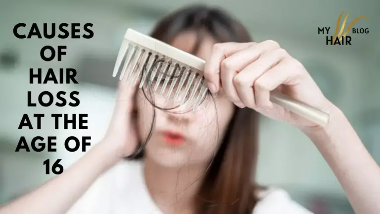 Causes of Hair Loss at the Age of 16