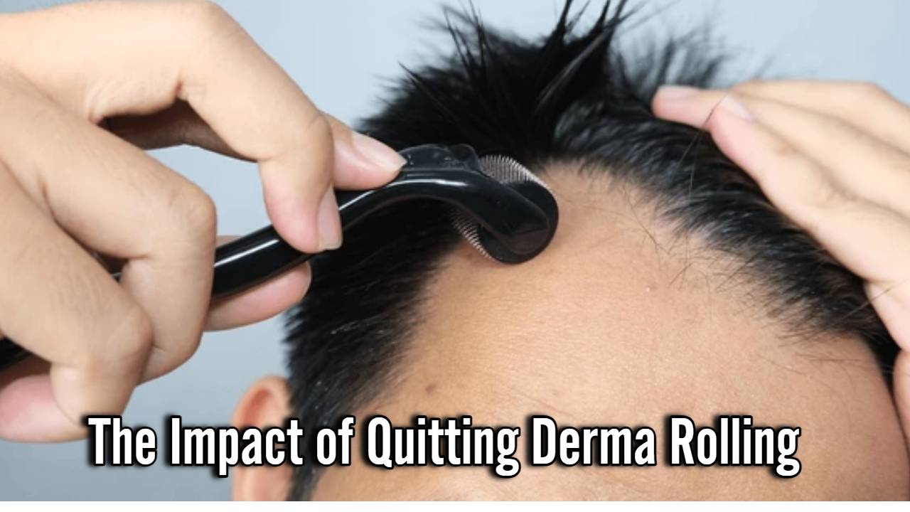 The Impact of Quitting Derma Rolling: Unveiling the Changes