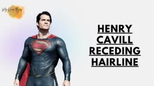 henry cavill receding hairline