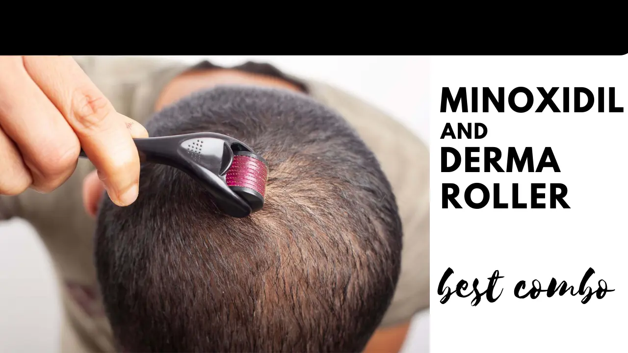 Minoxidil and Derma Roller: Using Togther! Guaranteed Results