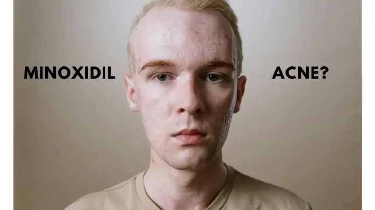 man with acne face